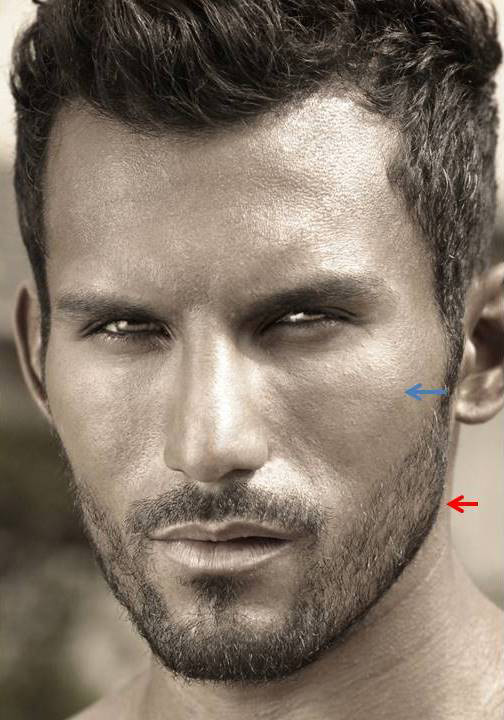 Male Facial Contouring (Implants) in Augusta The Center
