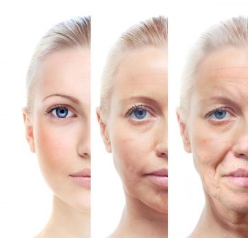 Facial Aging